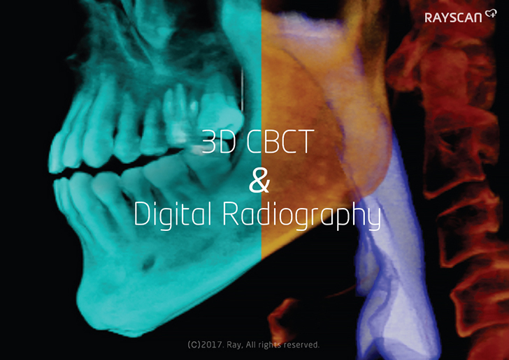 3D CBCT & Digital Radiography