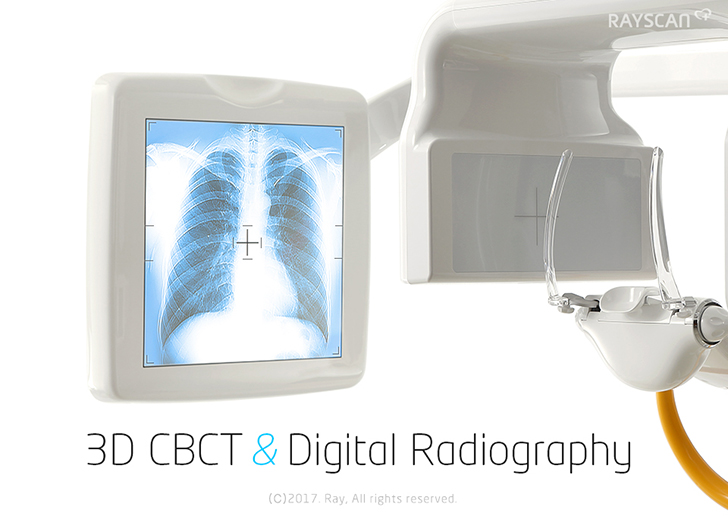 3D CBCT & Digital Radiography
