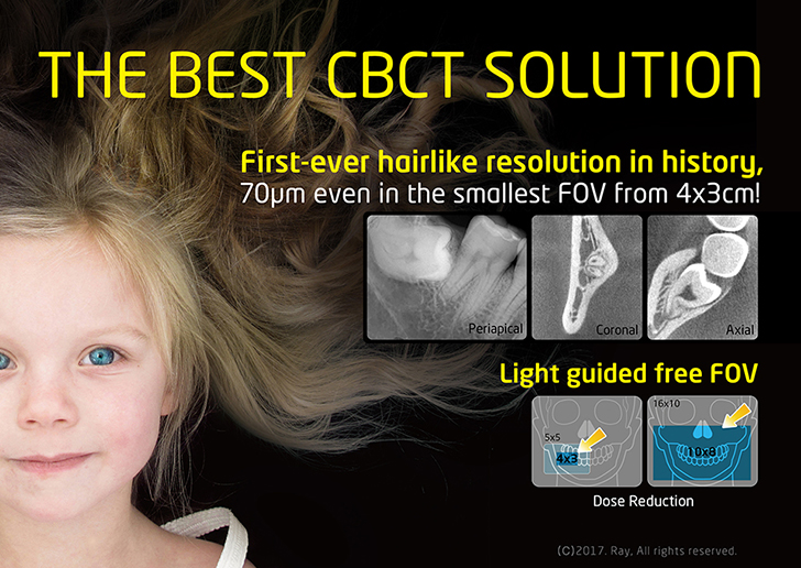 Best CBCT Solution for Endodontics