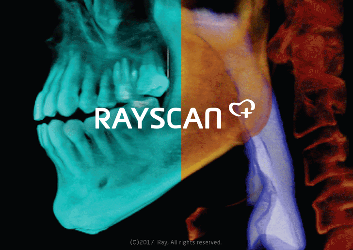 RAYSCAN m+