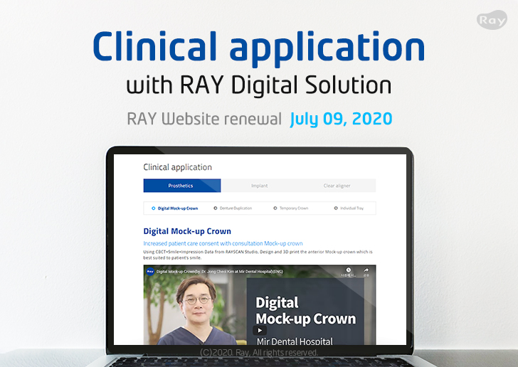Clinical application with RAY Digital Solution